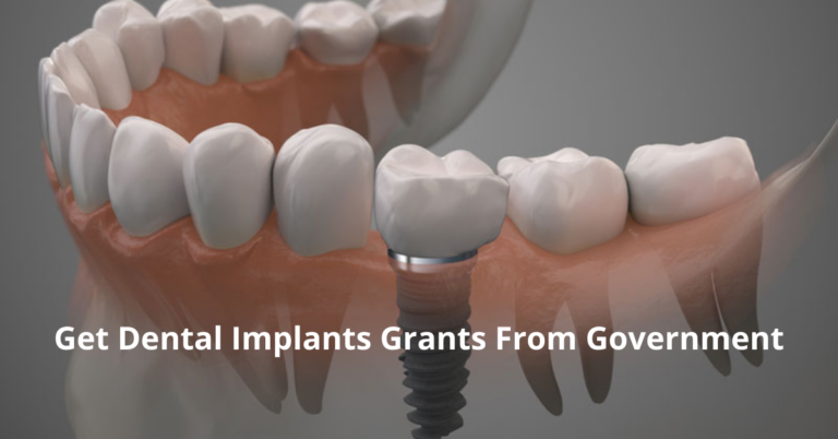 Get Dental Implants Grants From Government